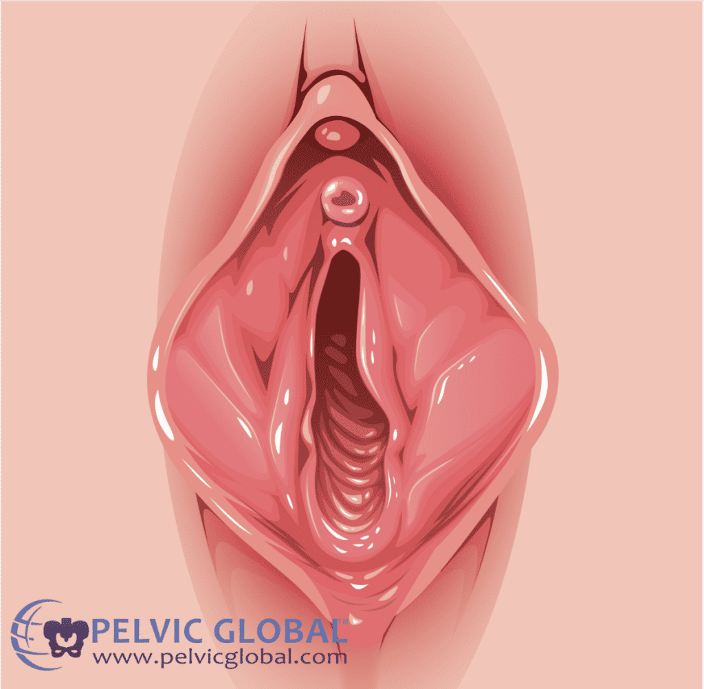 Aroused vulva with light toned skin.