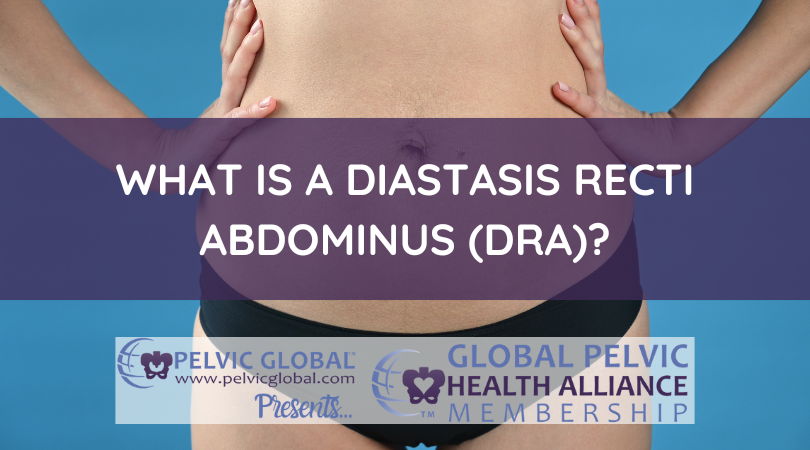 What is a Diastasis Recti Abdominum (DRA)?